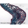 Набор микропрепаратов Bresser 100 шт., в кейсе 73765